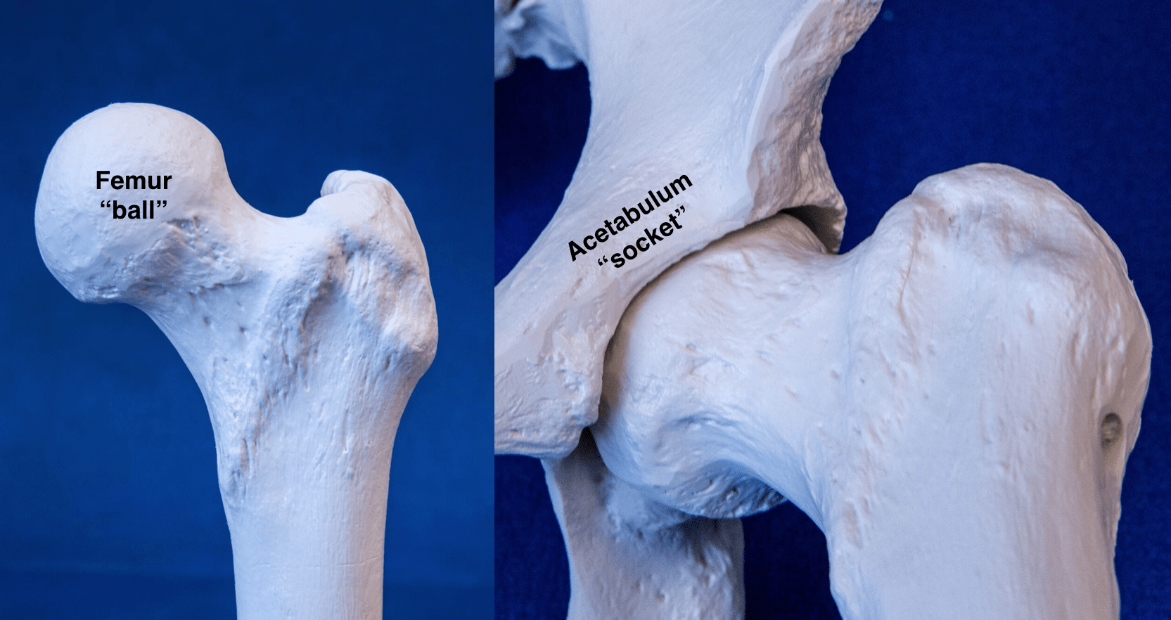 Hip Instability Treatment | North Hollywood | Los Angeles Orthopedic