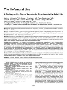 Kraeutler AJSM Sep2017 224x300 - The Iliofemoral Line : A Radiographic Sign of Acetabular Dysplasia in the Adult Hip