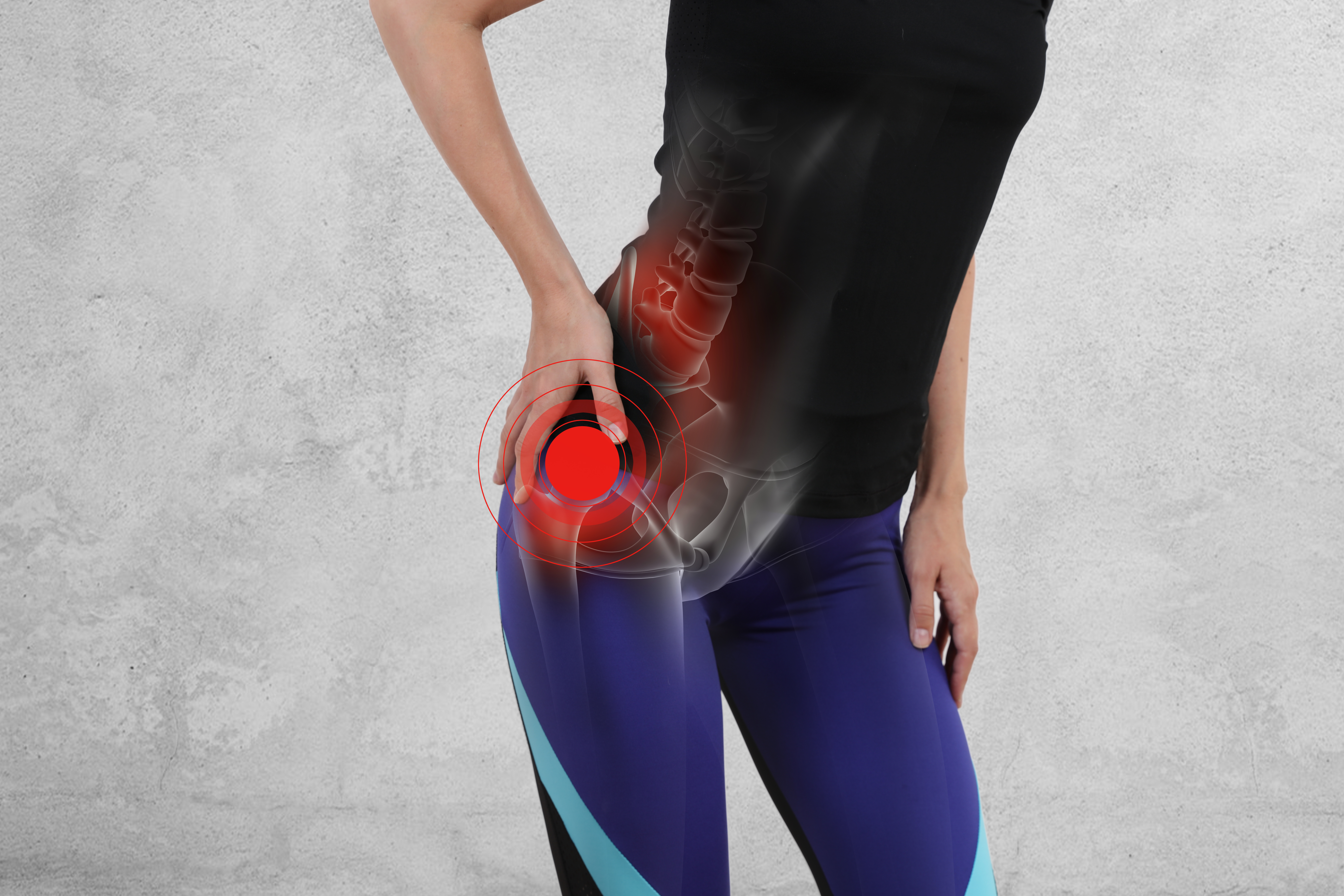 shutterstock 1117121852 - Am I a good candidate for hip replacement surgery?