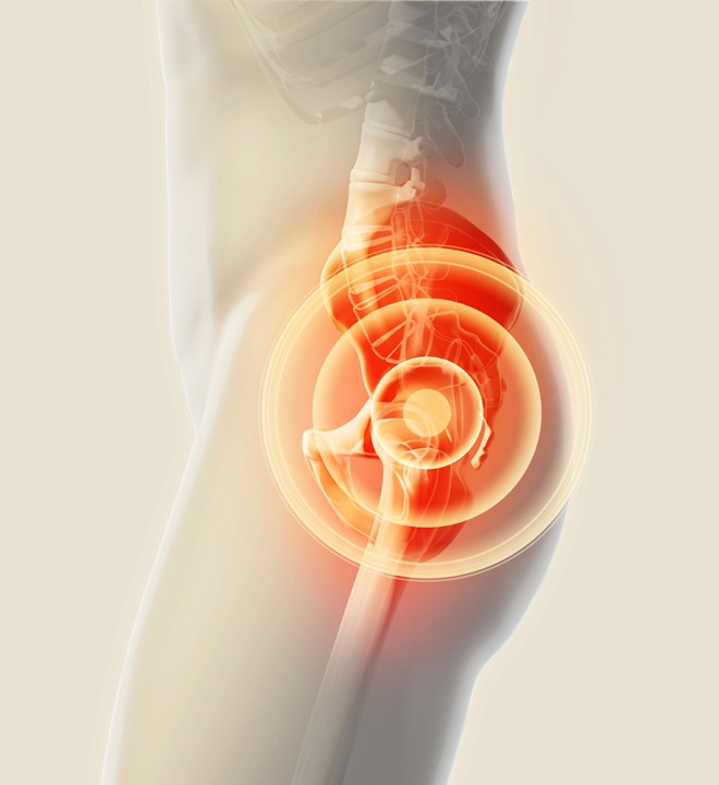 shutterstock 530879848 - What Are The First Signs of Hip Problems?